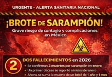CONFIRMAN SEGUNDO FALLECIMIENTO POR SARAMPIÓN EN 2026